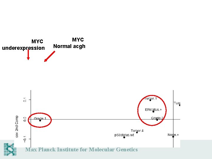 MYC underexpression MYC Normal acgh Max Planck Institute for Molecular Genetics 