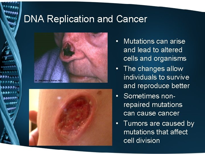 DNA Replication and Cancer • Mutations can arise and lead to altered cells and