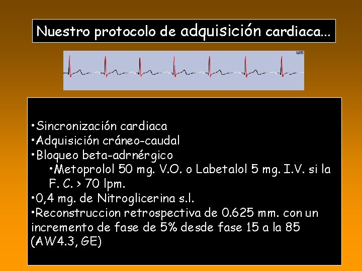 Nuestro protocolo de adquisición cardiaca. . . TCMD (GE) • Sincronización cardiaca • Adquisición