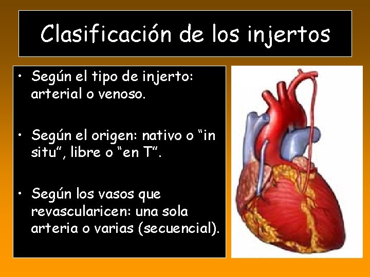 Clasificación de los injertos • Según el tipo de injerto: arterial o venoso. •
