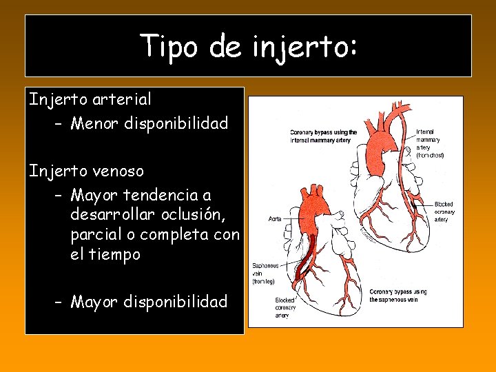 Tipo de injerto: Injerto arterial – Menor disponibilidad Injerto venoso – Mayor tendencia a