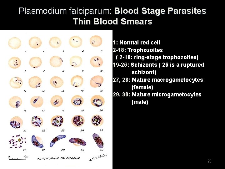 Plasmodium falciparum: Blood Stage Parasites Thin Blood Smears 1: Normal red cell 2 -18: