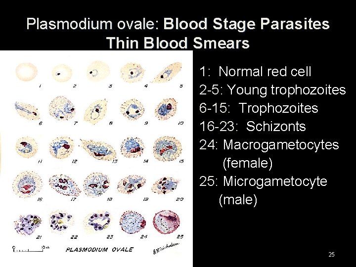 Plasmodium ovale: Blood Stage Parasites Thin Blood Smears 1: Normal red cell 2 -5:
