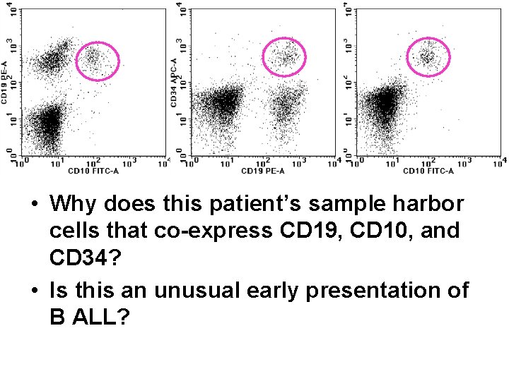  • Why does this patient’s sample harbor cells that co-express CD 19, CD