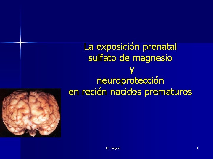 La exposición prenatal sulfato de magnesio y neuroprotección en recién nacidos prematuros Dr. Vega.