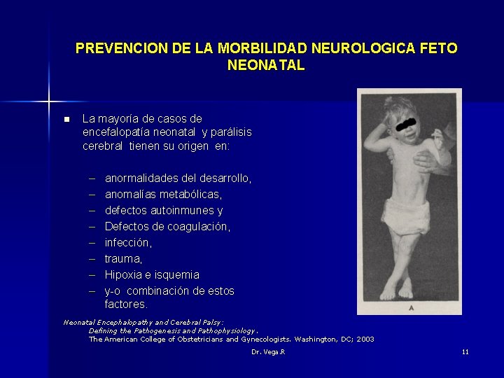 PREVENCION DE LA MORBILIDAD NEUROLOGICA FETO NEONATAL n La mayoría de casos de encefalopatía