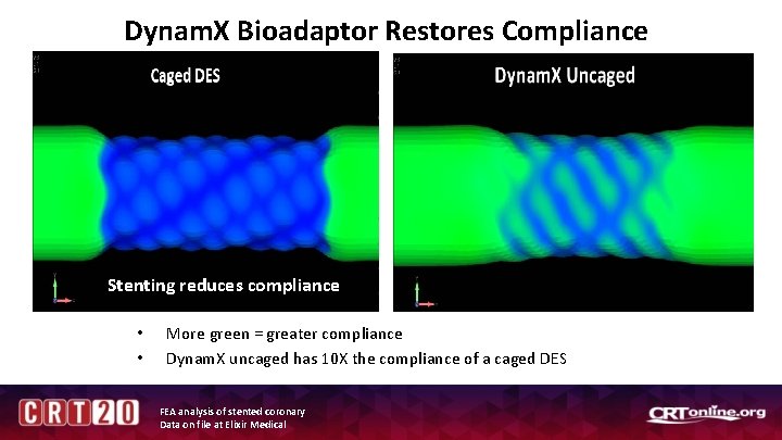 Dynam. X Bioadaptor Restores Compliance Stenting reduces compliance • • More green = greater