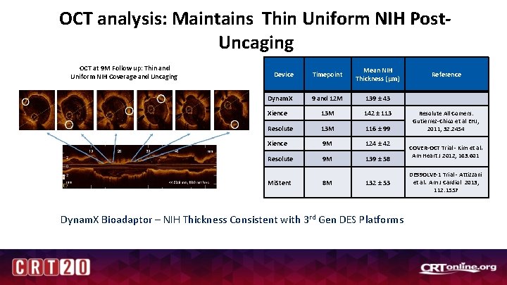 OCT analysis: Maintains Thin Uniform NIH Post. Uncaging OCT at 9 M Follow up: