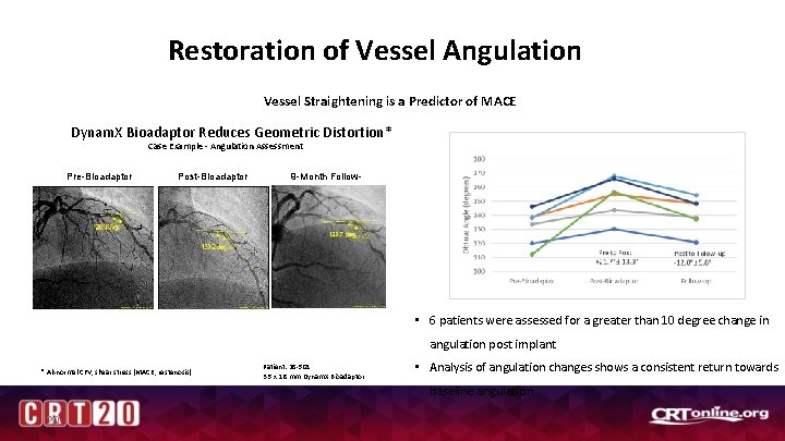 Restoration of Vessel Angulation Vessel Straightening is a Predictor of MACE Dynam. X Bioadaptor