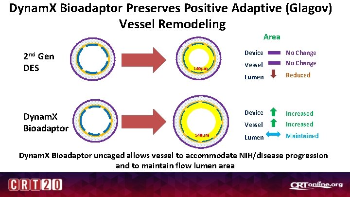 Dynam. X Bioadaptor Preserves Positive Adaptive (Glagov) Vessel Remodeling Area 2 nd Gen DES