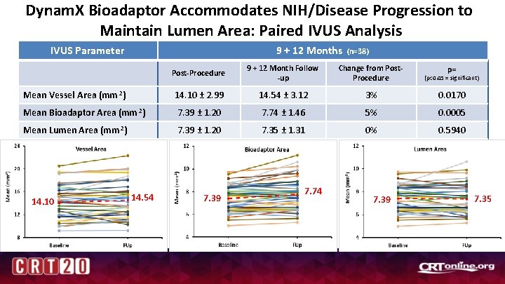 Dynam. X Bioadaptor Accommodates NIH/Disease Progression to Maintain Lumen Area: Paired IVUS Analysis 9