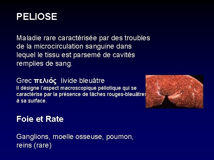 PELIOSE Maladie rare caractérisée par des troubles de la microcirculation sanguine dans lequel le