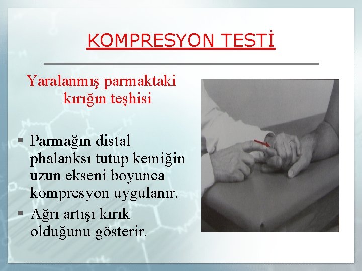 KOMPRESYON TESTİ Yaralanmış parmaktaki kırığın teşhisi § Parmağın distal phalanksı tutup kemiğin uzun ekseni