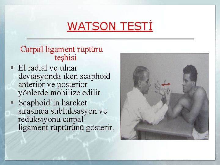 WATSON TESTİ Carpal ligament rüptürü teşhisi § El radial ve ulnar deviasyonda iken scaphoid
