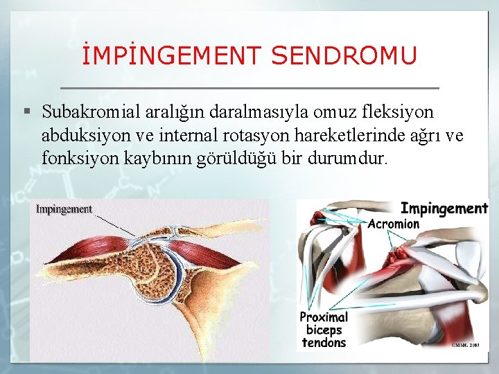 İMPİNGEMENT SENDROMU § Subakromial aralığın daralmasıyla omuz fleksiyon abduksiyon ve internal rotasyon hareketlerinde ağrı