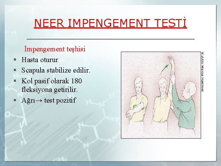 NEER IMPENGEMENT TESTİ § § İmpengement teşhisi Hasta oturur Scapula stabilize edilir. Kol pasif