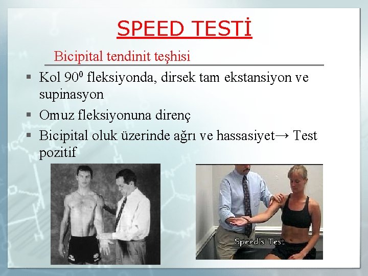SPEED TESTİ Bicipital tendinit teşhisi § Kol 900 fleksiyonda, dirsek tam ekstansiyon ve supinasyon