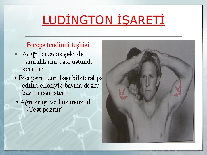 LUDİNGTON İŞARETİ Biceps tendiniti teşhisi § Aşağı bakacak şekilde parmaklarını başı üstünde kenetler •