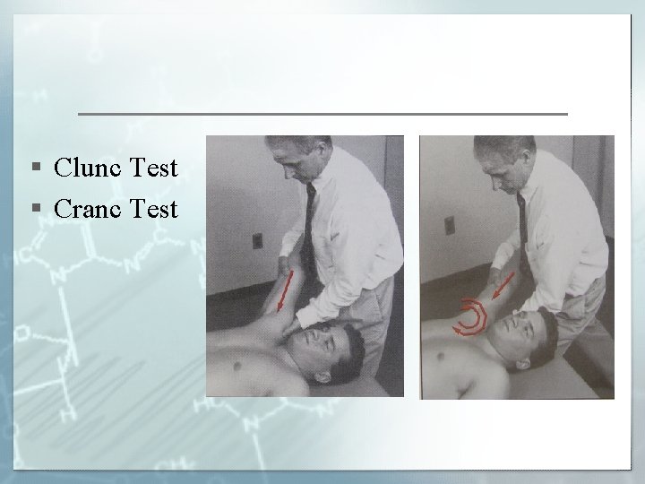 § Clunc Test § Cranc Test 