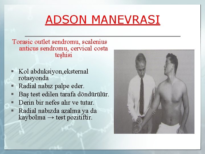 ADSON MANEVRASI Torasic outlet sendromu, scalenius anticus sendromu, cervical costa teşhisi § Kol abduksiyon,