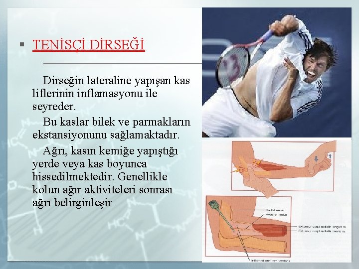 § TENİSÇİ DİRSEĞİ Dirseğin lateraline yapışan kas liflerinin inflamasyonu ile seyreder. Bu kaslar bilek