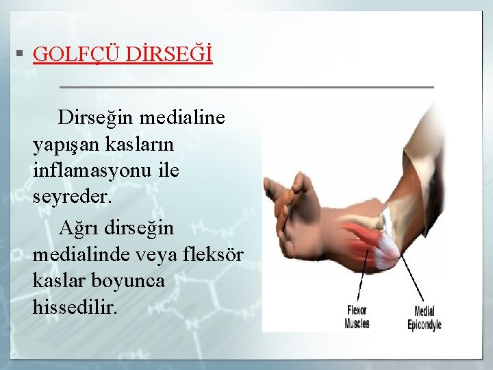 § GOLFÇÜ DİRSEĞİ Dirseğin medialine yapışan kasların inflamasyonu ile seyreder. Ağrı dirseğin medialinde veya