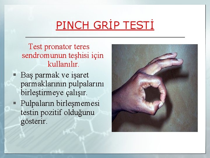 PINCH GRİP TESTİ Test pronator teres sendromunun teşhisi için kullanılır. § Baş parmak ve