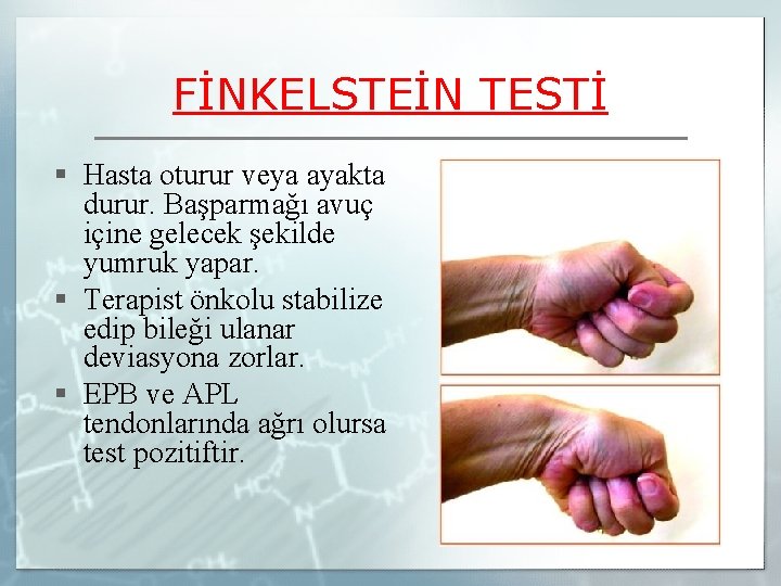 FİNKELSTEİN TESTİ § Hasta oturur veya ayakta durur. Başparmağı avuç içine gelecek şekilde yumruk