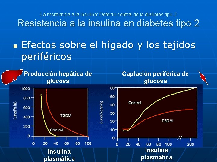 La resistencia a la insulina: Defecto central de la diabetes tipo 2 Resistencia a