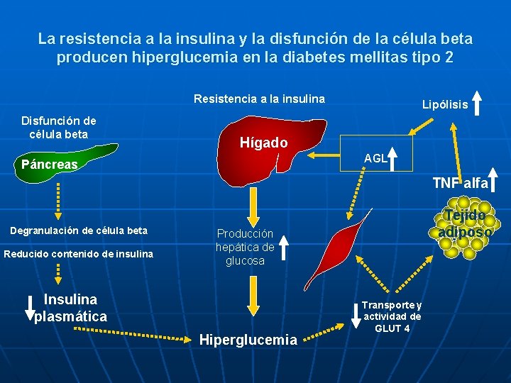 La resistencia a la insulina y la disfunción de la célula beta producen hiperglucemia