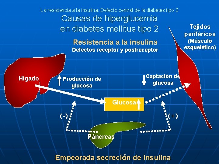 La resistencia a la insulina: Defecto central de la diabetes tipo 2 Causas de