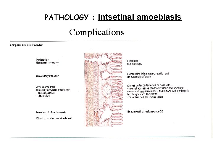 PATHOLOGY : Intsetinal amoebiasis Complications 