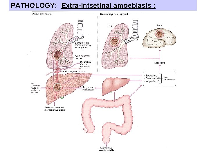 PATHOLOGY: Extra-intsetinal amoebiasis : 