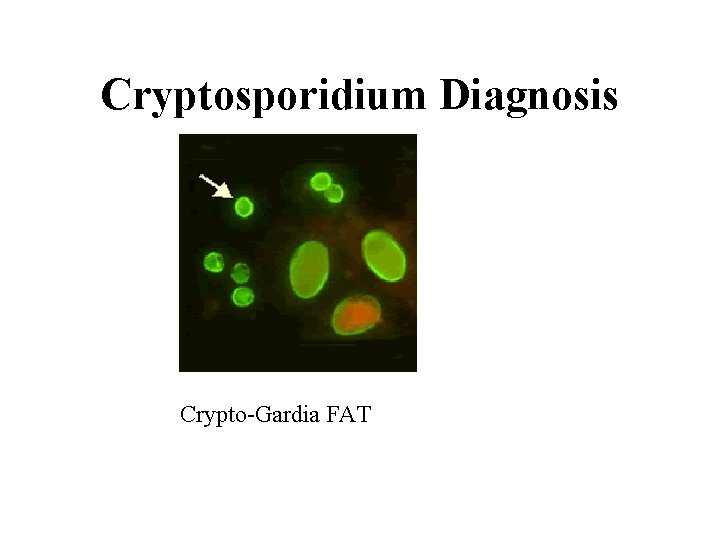 Cryptosporidium Diagnosis Crypto-Gardia FAT 