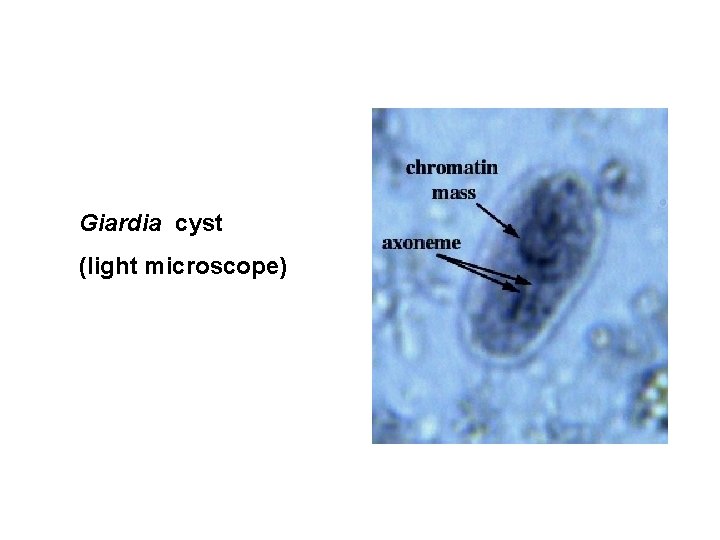 Giardia cyst (light microscope) 