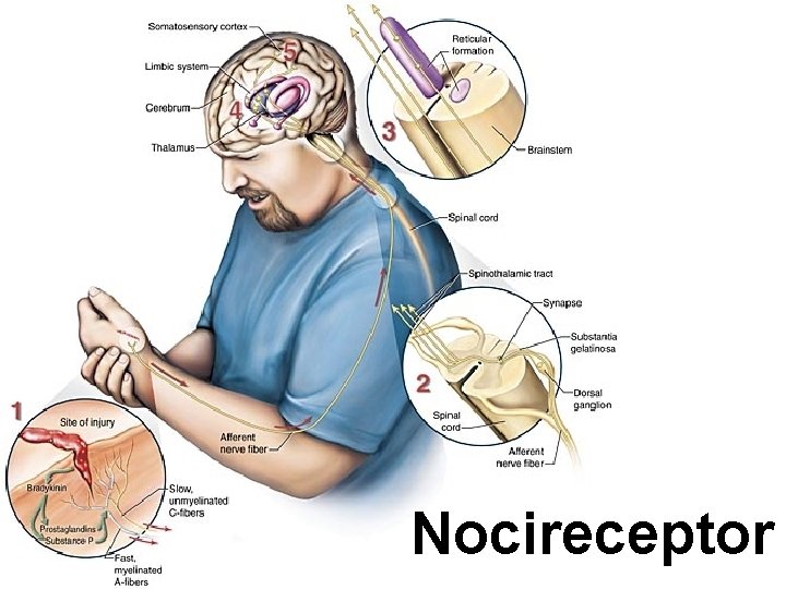 Nocireceptor 
