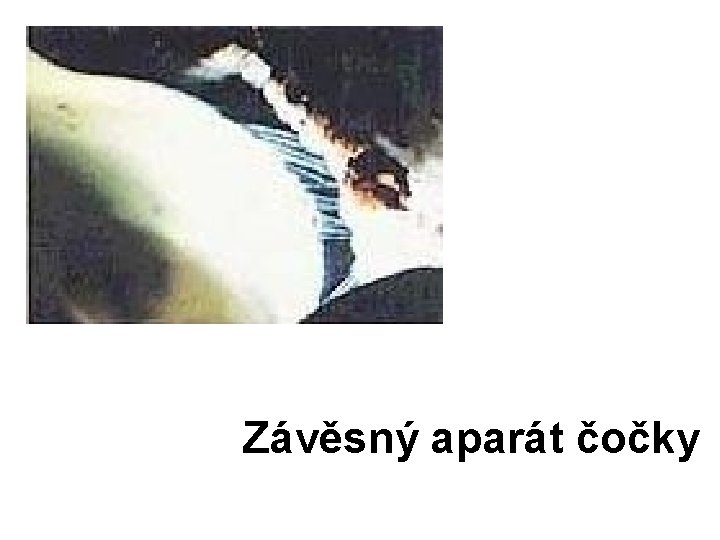 Závěsný aparát čočky 