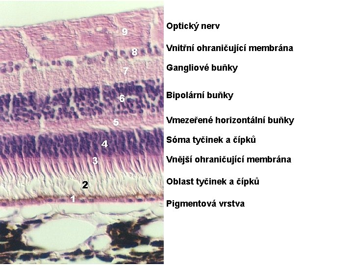Optický nerv Vnitřní ohraničující membrána Gangliové buňky Bipolární buňky Vmezeřené horizontální buňky Sóma tyčinek