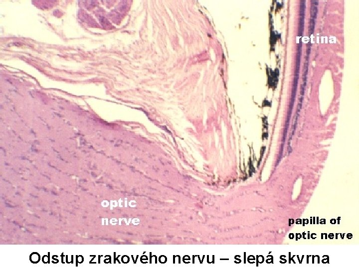 Odstup zrakového nervu – slepá skvrna 