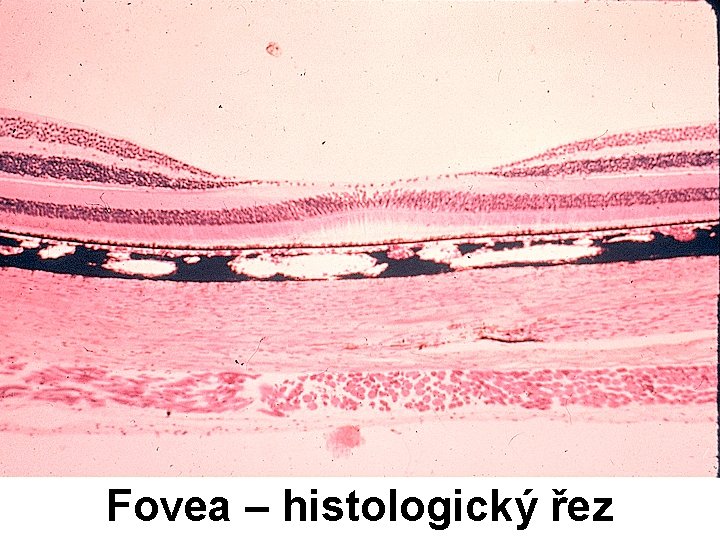 Fovea – histologický řez 