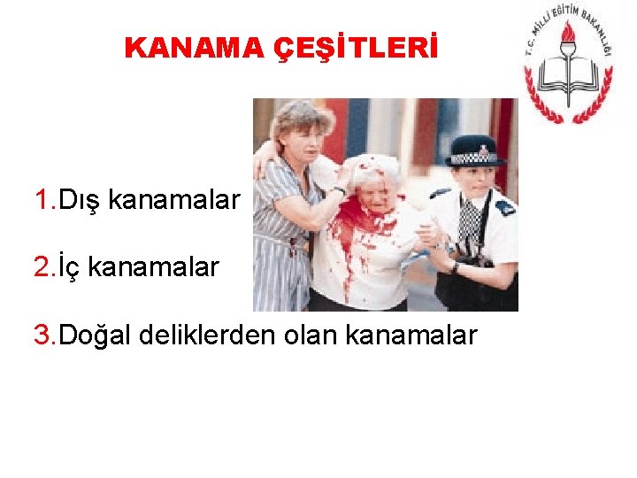 KANAMA ÇEŞİTLERİ 1. Dış kanamalar 2. İç kanamalar 3. Doğal deliklerden olan kanamalar 