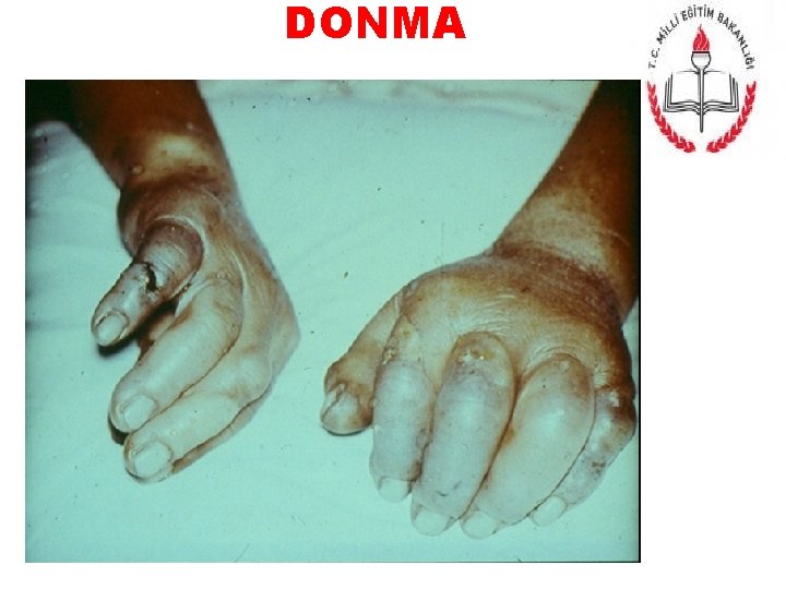 DONMA 