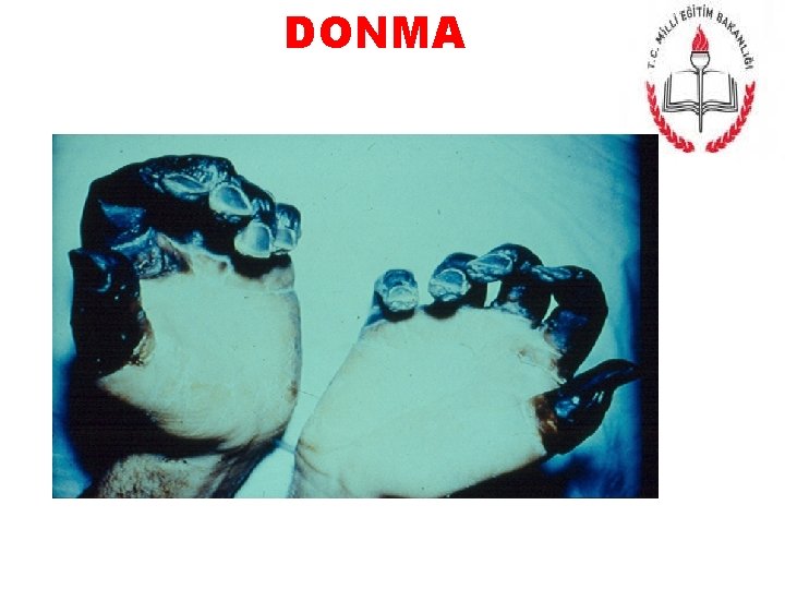 DONMA 