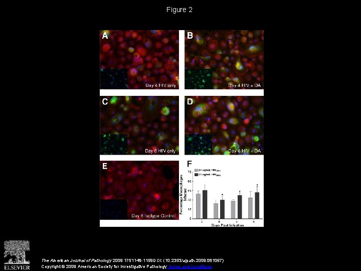 Figure 2 The American Journal of Pathology 2009 1751148 -1159 DOI: (10. 2353/ajpath. 2009.