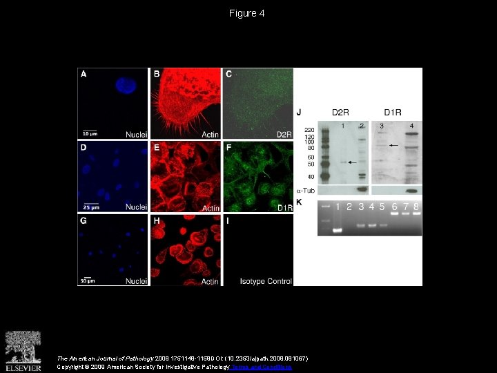 Figure 4 The American Journal of Pathology 2009 1751148 -1159 DOI: (10. 2353/ajpath. 2009.