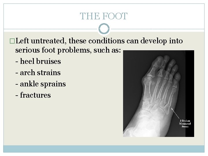 THE FOOT �Left untreated, these conditions can develop into serious foot problems, such as: