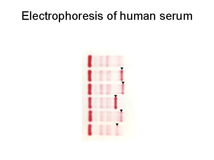 Electrophoresis of human serum 