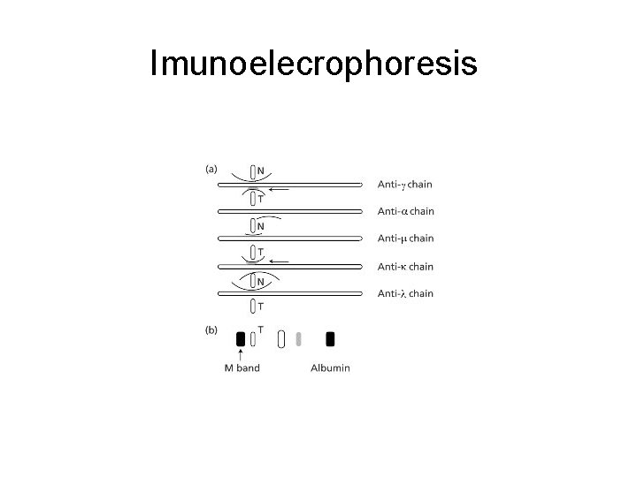 Imunoelecrophoresis 