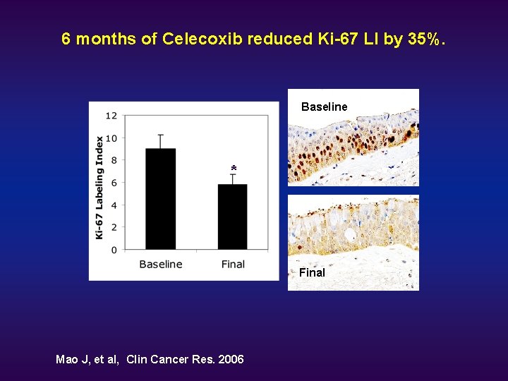 6 months of Celecoxib reduced Ki-67 LI by 35%. Baseline * Final Mao J,