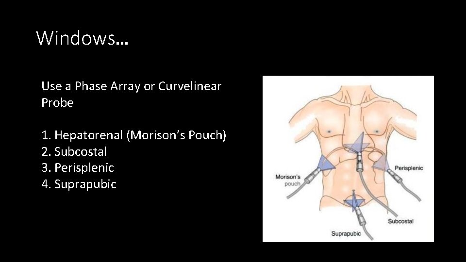 Windows… Use a Phase Array or Curvelinear Probe 1. Hepatorenal (Morison’s Pouch) 2. Subcostal